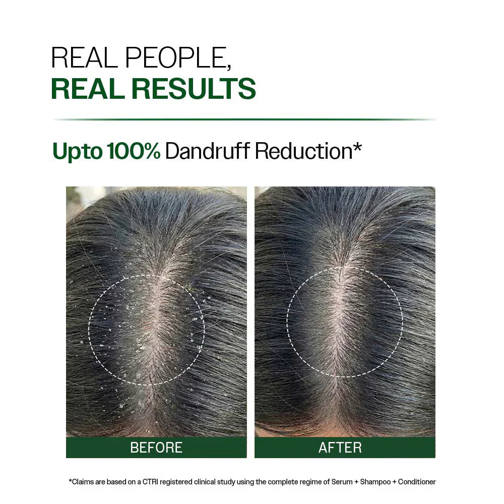 Pack of 2 Anti Dandruff Shampoo with Salicylic Acid, Piroctone Olamine & Biotin - 250ml