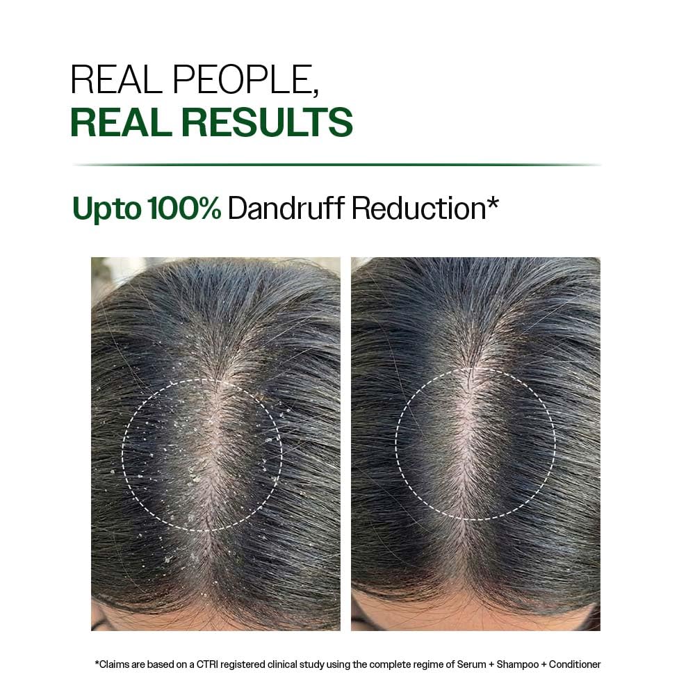 Anti-Dandruff Shampoo | Up To 100% Dandruff Reduction | ZPTO-Free | pH 5.3 | Salicylic Acid, Piroctone Olamine, Biotin &amp; Menthol | Non-Drying Formula | Suitable for Men &amp; Women | 250 ml